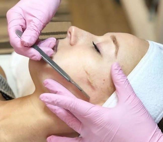 Smooth dermaplaning cheek exfoliation procedure for peach fuzz removal
