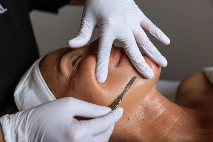 Professional dermaplaning facial exfoliation procedure in Lower Manhattan
