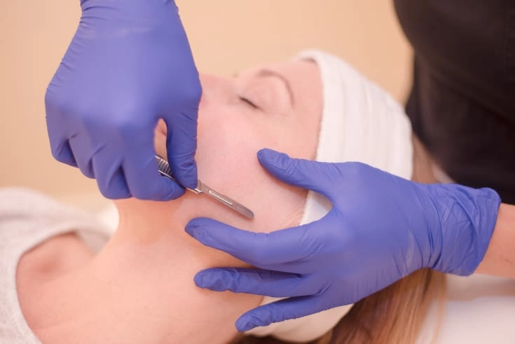 Esthetician performing precise dermaplaning facial scalpel treatment